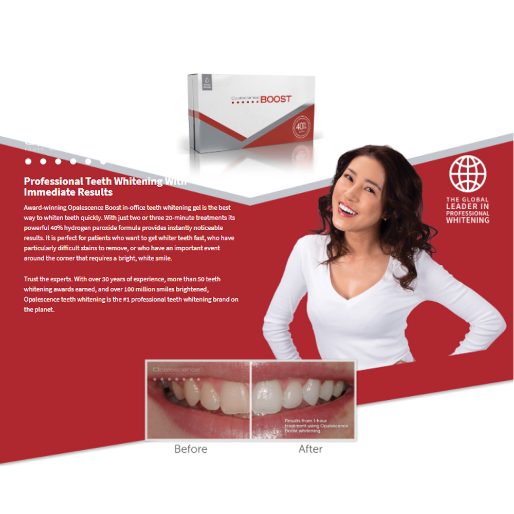Opalescence Boost 40% PF Ameri - đánh giá và giá Teeth Whitening Gel Opalescence