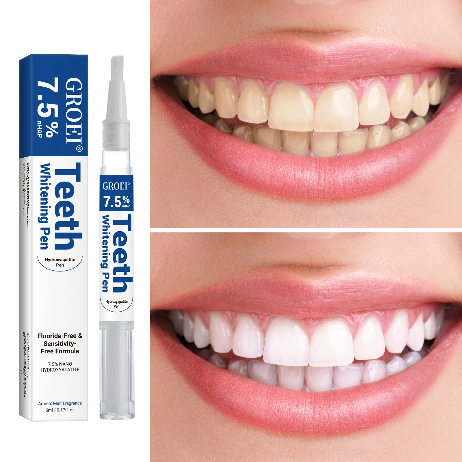 Hydroxyapatite Tooth Whitening - đánh giá và giá Teeth Whitening With Hydrogen Peroxide