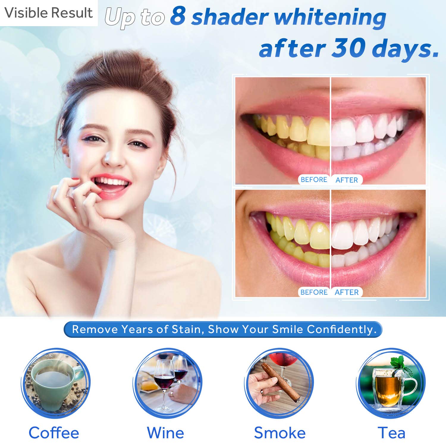 Teeth Whitening Gel Refill Syr - đánh giá và giá Teeth Whitening With Hydrogen Peroxide