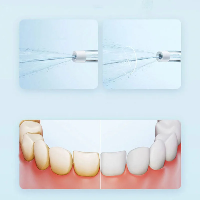 Xiaomi Portable Oral Irrigator - đánh giá và giá Teeth Whitening Quick