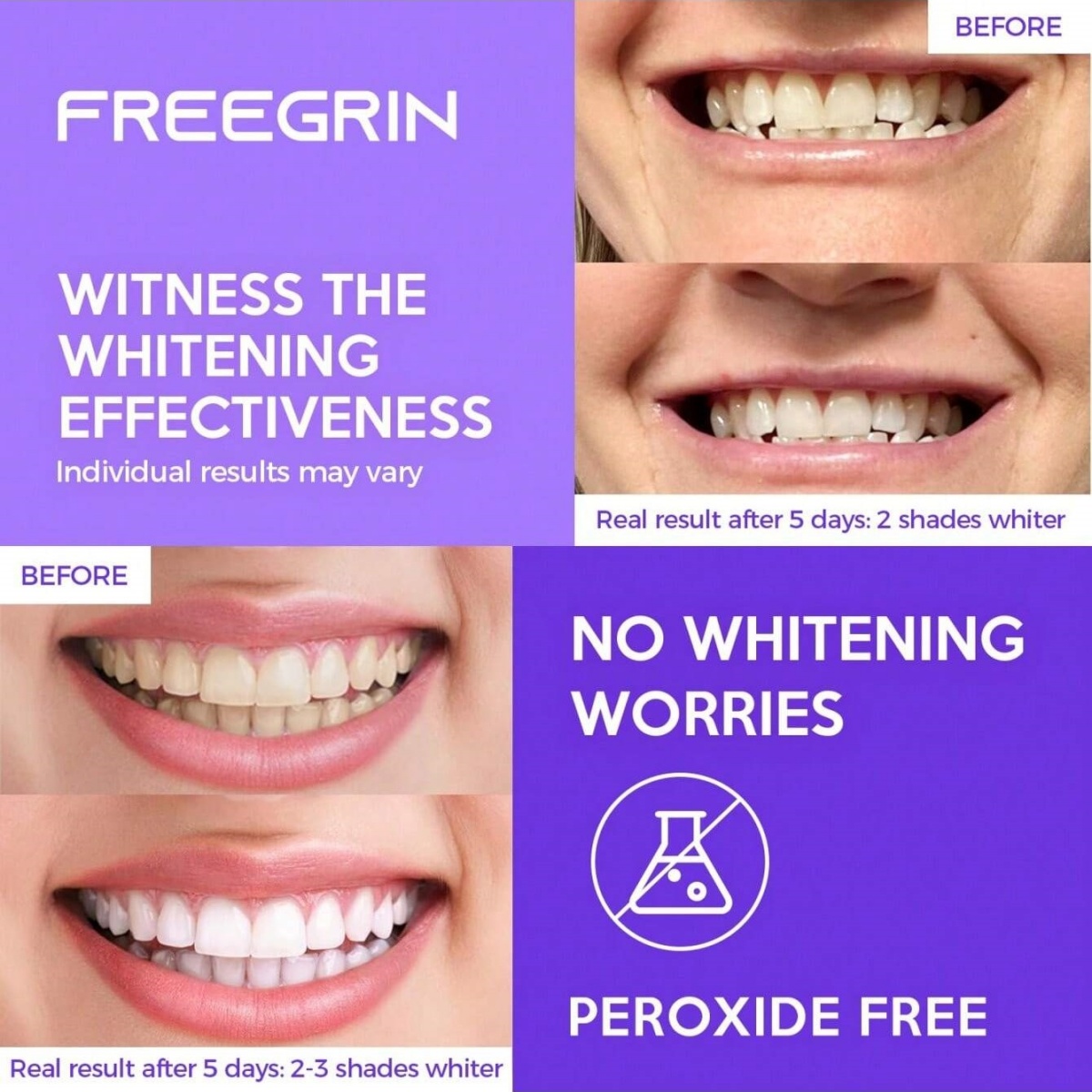 Deluxe Whitening Teeth Sticker - đánh giá và giá Teeth Whitening With Hydrogen Peroxide